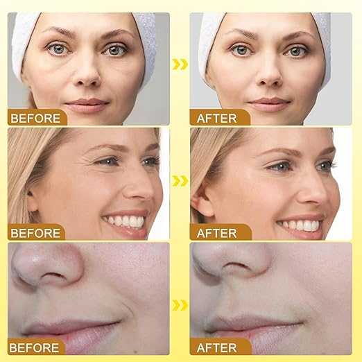 Botox Bee Venom Cream | كريم البوتوكس بسمّ النحل